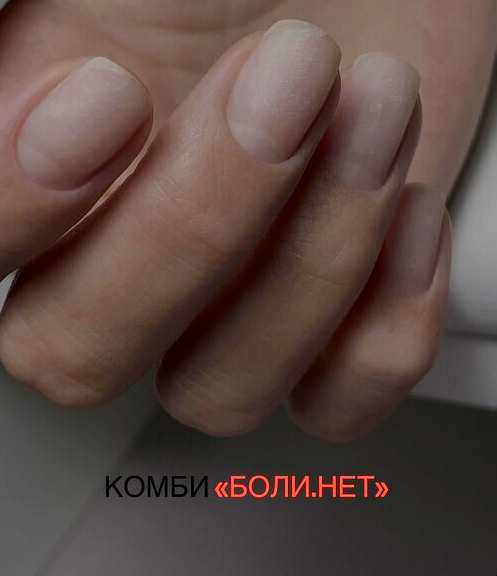[Osa.nails] Комби Боли.нет [Мария Осовицкая]