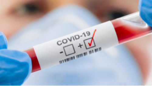 Covid 2025: Перспектива добровольного концлагеря [Евгений Гильбо]