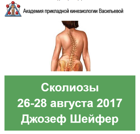 Сколиозы [Джозеф Шейфер]